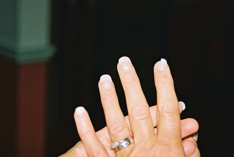 Main gauche de femme avec l'ongle de l'index cassé